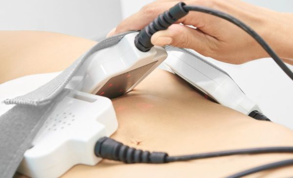 A Non-Invasive Liposuction Treatment in Randpark Ridge
