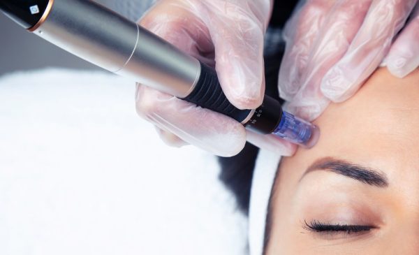 micro needling facial with LED light display