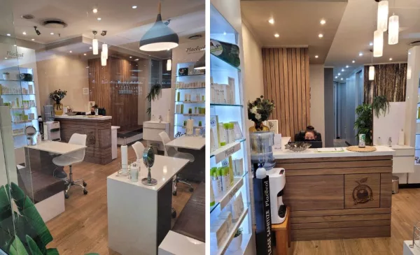 Microneedling session