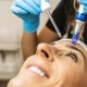Microneedling session