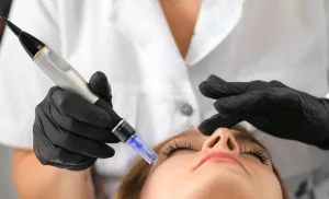 microneedling