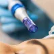 Microneedling with a Facial in Sandton