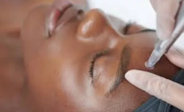 Combo Dermaplaning and Microneedling in Durban - Image 10