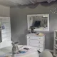 ear acupuncture