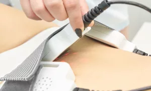 Lipo Laser