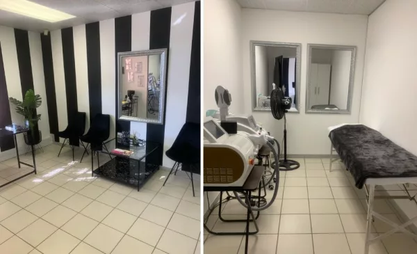 Fat freezing in Randburg - Image 2