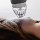 Microneedling in Bryanston