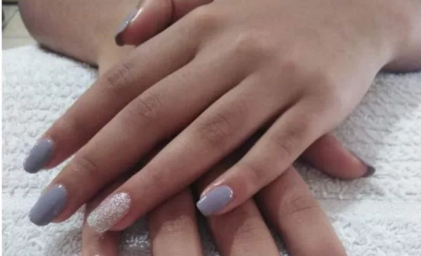 gel overlays