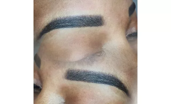 Forget shaving or waxing with a laser hair removal session in Pretoria