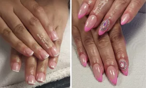 gel overlay