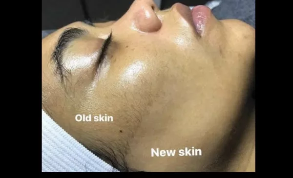 Revitalize Your Skin with a Glow-up Facial Combo