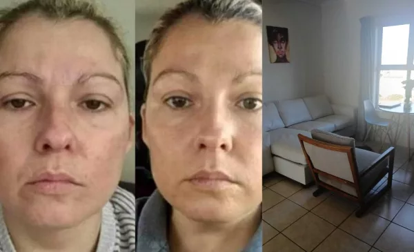 Elevate Your Look with a Non Surgical Face-lift in Muizenburg - Image 2