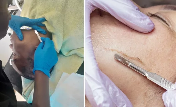 Rejuvenate your skin with a dermaplaning and LED mask in Durban