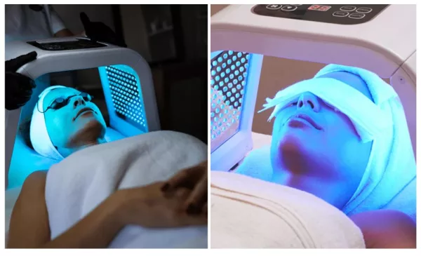Rejuvenate Your Skin with Jet Plasma Sessions and LED Light Therapy - Image 2