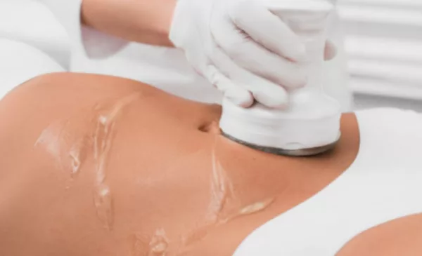 Slim Down with Liposonix on Your Outer Thighs